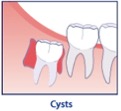 cysts iconography