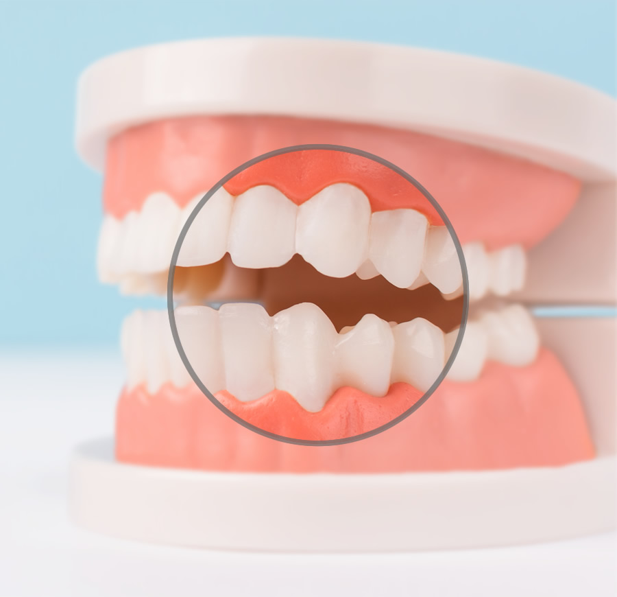 Teeth model