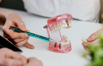 Dentist explaining dental implant treatment on a dental model.
